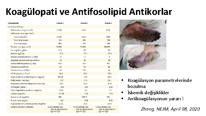 Koagülopati ve Antifosolipid Antikorlar § Koagülasyon parametrelerinde bozulma § İskemik değişiklikler § Antikoagülasyonun yararı