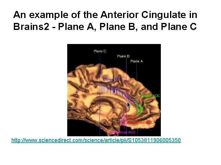 An example of the Anterior Cingulate in Brains 2 - Plane A, Plane B,