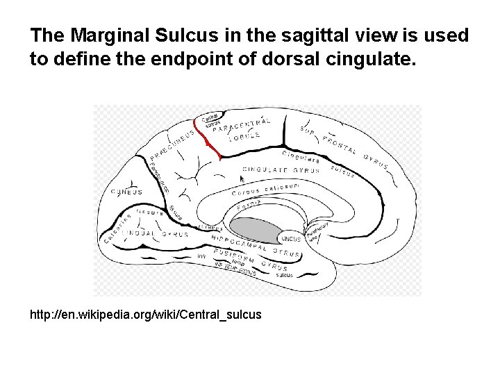The Marginal Sulcus in the sagittal view is used to define the endpoint of