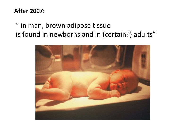 After 2007: ” in man, brown adipose tissue is found in newborns and in