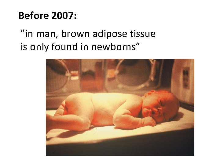 Before 2007: ”in man, brown adipose tissue is only found in newborns” 