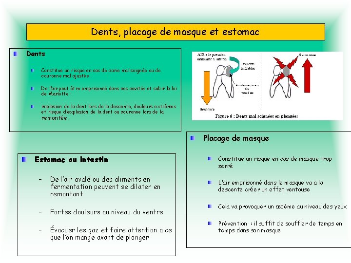 Dents, placage de masque et estomac Dents Constitue un risque en cas de carie