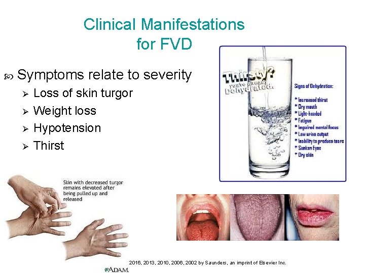 Clinical Manifestations for FVD Symptoms relate to severity Ø Ø Loss of skin turgor