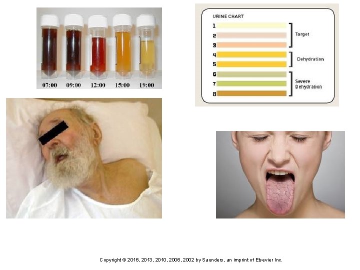 24 Copyright © 2016, 2013, 2010, 2006, 2002 by Saunders, an imprint of Elsevier