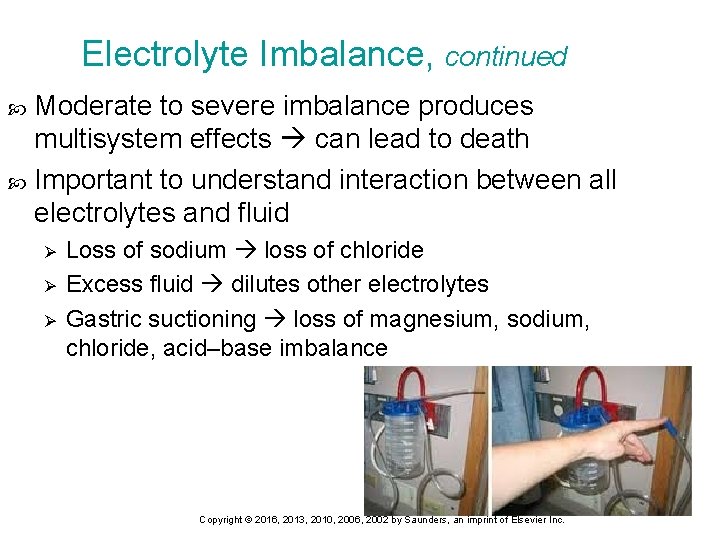 Electrolyte Imbalance, continued Moderate to severe imbalance produces multisystem effects can lead to death