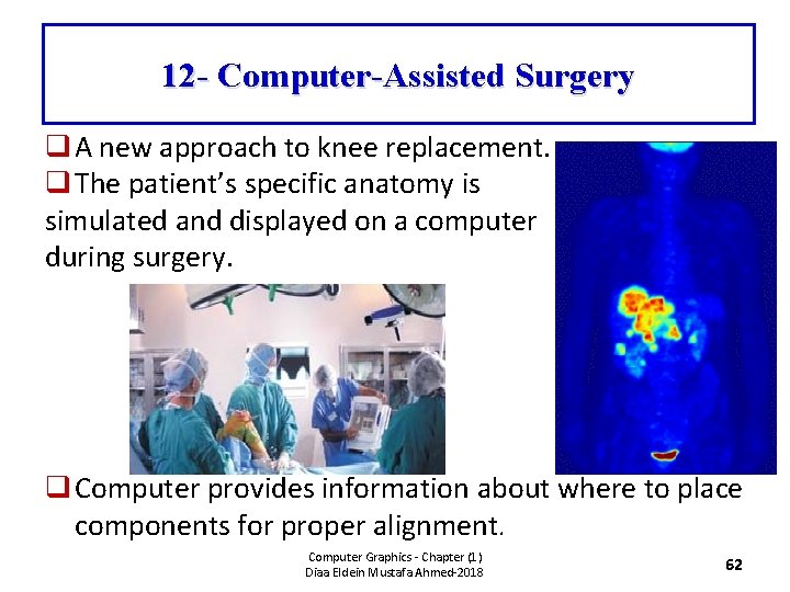 12 - Computer-Assisted Surgery q A new approach to knee replacement. q The patient’s