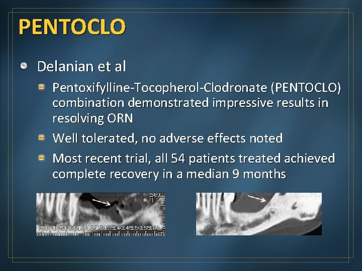 PENTOCLO Delanian et al Pentoxifylline-Tocopherol-Clodronate (PENTOCLO) combination demonstrated impressive results in resolving ORN Well
