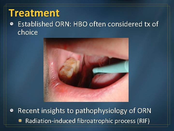 Treatment Established ORN: HBO often considered tx of choice Recent insights to pathophysiology of