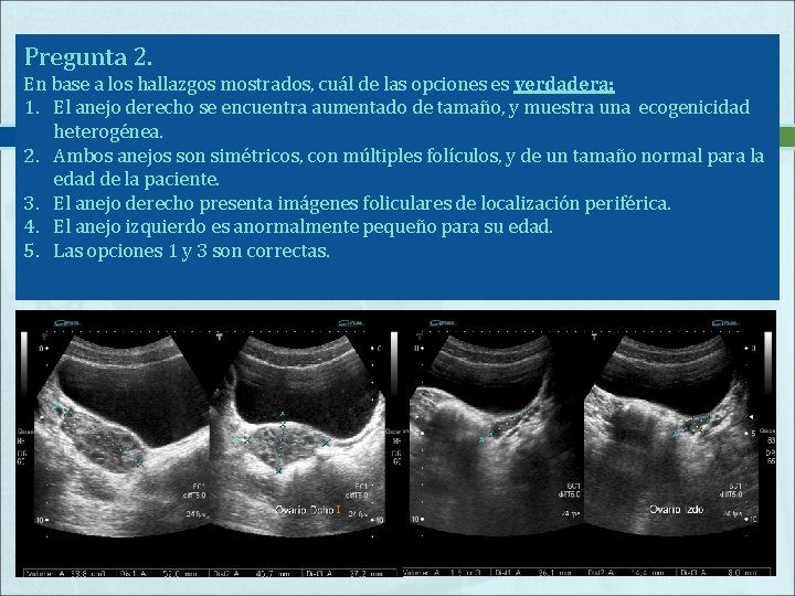 Pregunta 2. En base a los hallazgos mostrados, cuál de las opciones es verdadera: