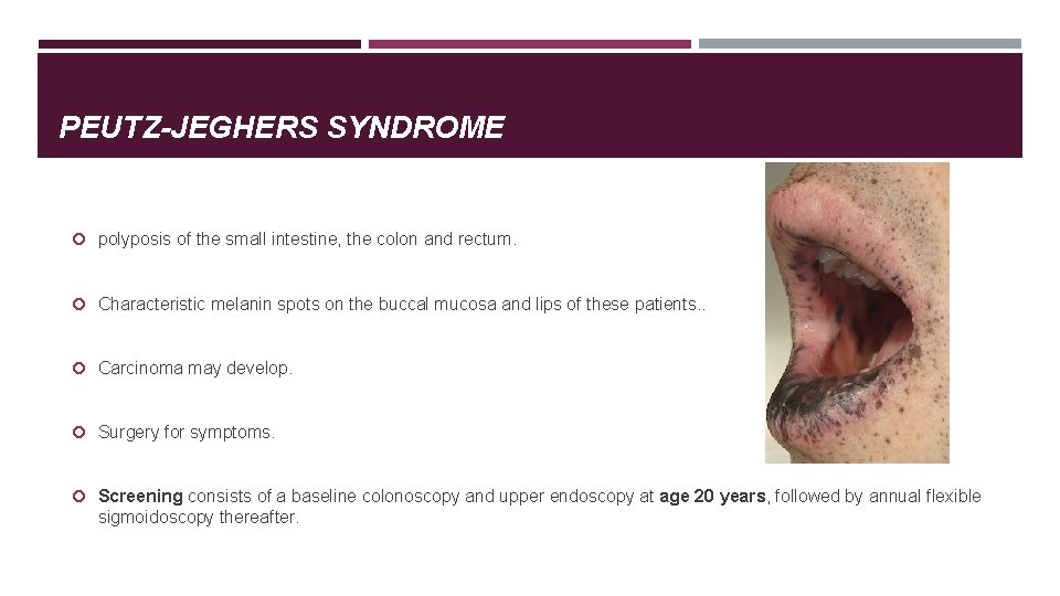 PEUTZ-JEGHERS SYNDROME polyposis of the small intestine, the colon and rectum. Characteristic melanin spots