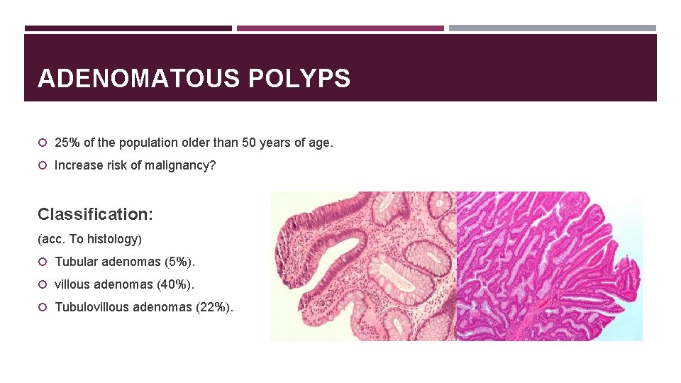 ADENOMATOUS POLYPS 25% of the population older than 50 years of age. Increase risk