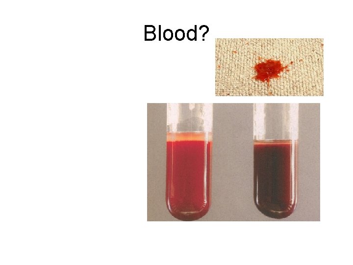 Blood? 