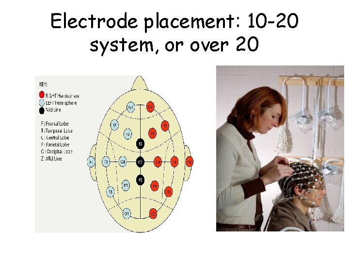 Electrode placement: 10 -20 system, or over 20 