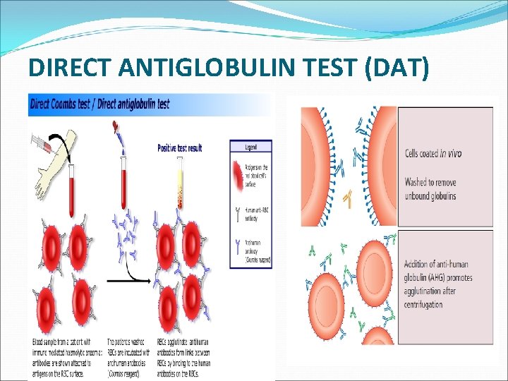 DIRECT ANTIGLOBULIN TEST (DAT) 