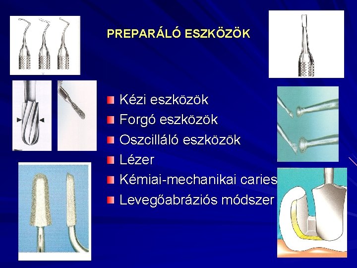 PREPARÁLÓ ESZKÖZÖK Kézi eszközök Forgó eszközök Oszcilláló eszközök Lézer Kémiai-mechanikai caries eltávolítás Levegőabráziós módszer