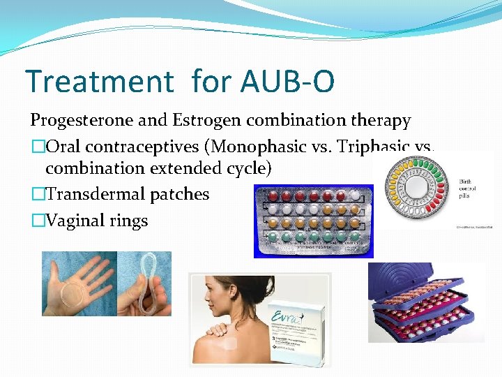 Treatment for AUB-O Progesterone and Estrogen combination therapy �Oral contraceptives (Monophasic vs. Triphasic vs.