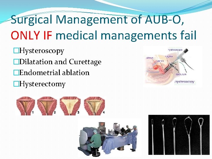 Surgical Management of AUB-O, ONLY IF medical managements fail �Hysteroscopy �Dilatation and Curettage �Endometrial
