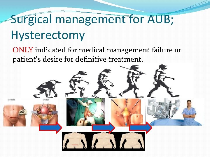 Surgical management for AUB; Hysterectomy ONLY indicated for medical management failure or patient’s desire