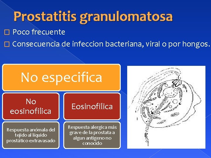 Prostatitis granulomatosa Poco frecuente � Consecuencia de infeccion bacteriana, viral o por hongos. �