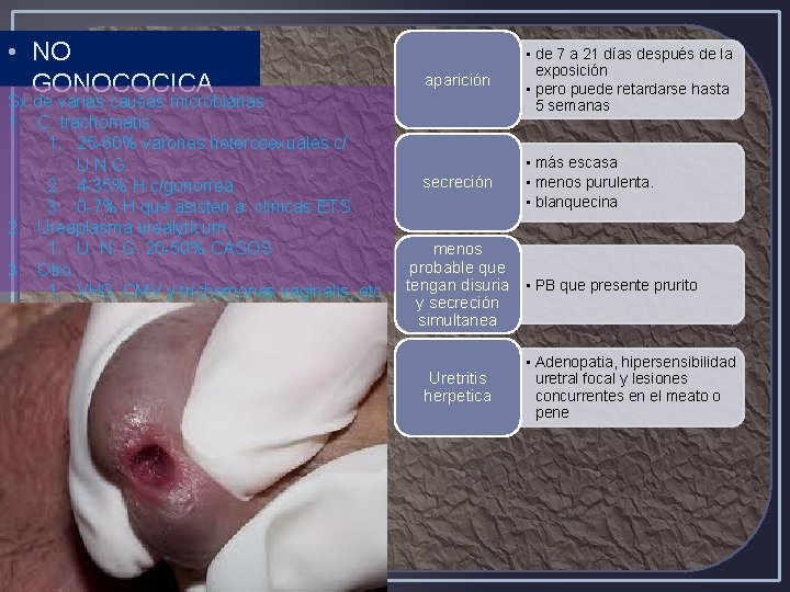  • NO GONOCOCICA Sx de varias causas microbianas 1. C. trachomatis. 1. 25