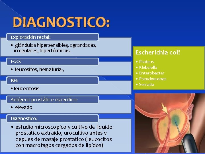 DIAGNOSTICO: Exploración rectal: • glándulas hipersensibles, agrandadas, irregulares, hipertérmicas. EGO: • leucositos, hematuria-, BH: