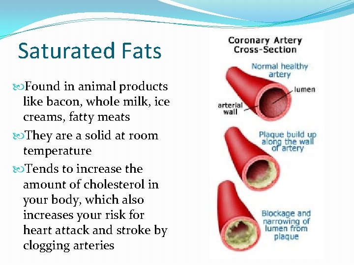 Saturated Fats Found in animal products like bacon, whole milk, ice creams, fatty meats