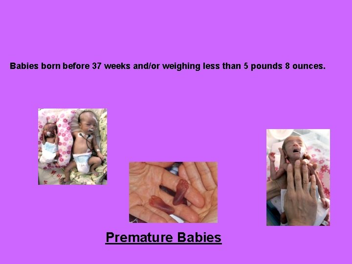 Babies born before 37 weeks and/or weighing less than 5 pounds 8 ounces. Premature