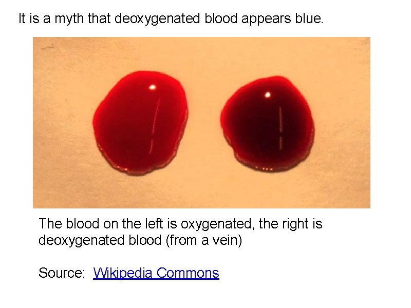 It is a myth that deoxygenated blood appears blue. The blood on the left