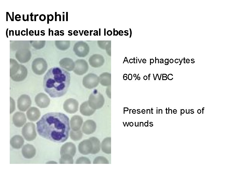 Neutrophil (nucleus has several lobes) Active phagocytes 60% of WBC Present in the pus