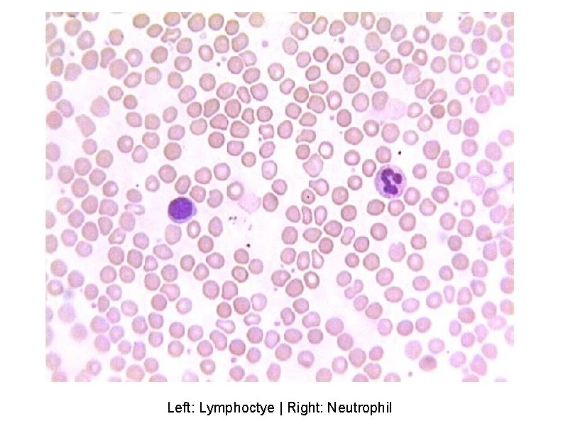 Left: Lymphoctye | Right: Neutrophil 