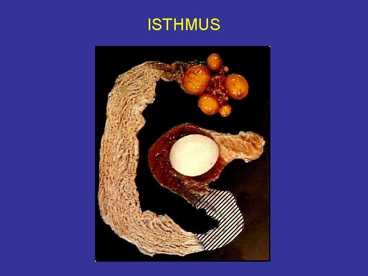 ISTHMUS 