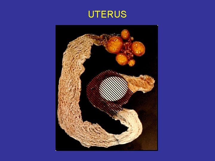 UTERUS 