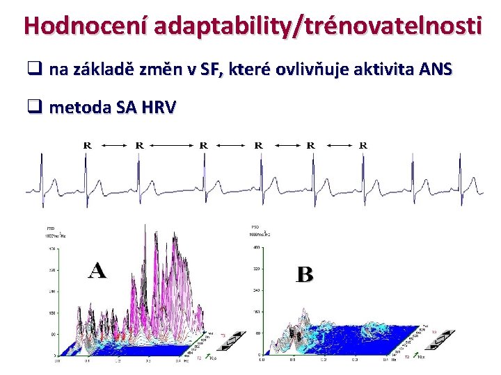 Hodnocení adaptability/trénovatelnosti q na základě změn v SF, které ovlivňuje aktivita ANS q metoda