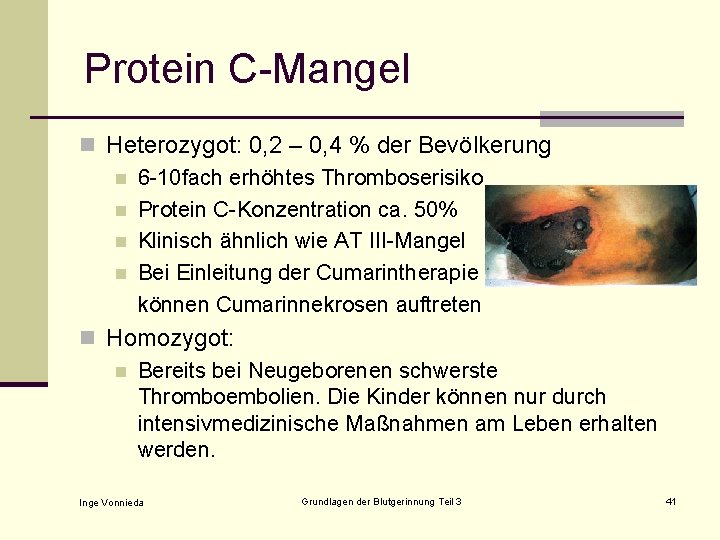 Protein C-Mangel n Heterozygot: 0, 2 – 0, 4 % der Bevölkerung n 6