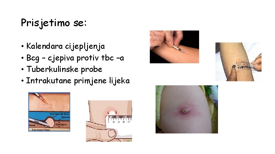 Prisjetimo se: • Kalendara cijepljenja • Bcg – cjepiva protiv tbc –a • Tuberkulinske