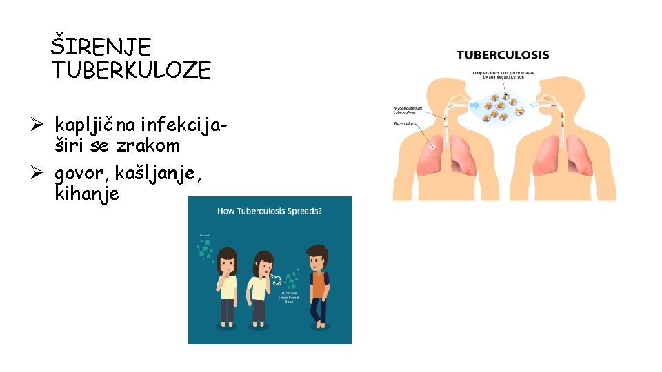 ŠIRENJE TUBERKULOZE Ø kapljična infekcijaširi se zrakom Ø govor, kašljanje, kihanje 