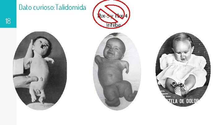 Dato curioso: Talidomida 18 Tbx-5 y Tbx-4 Inhibe 