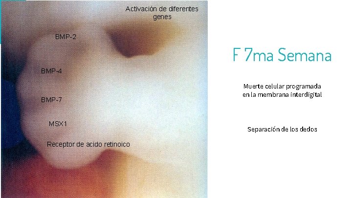 se distinguen Activación de diferentes genes 26 BMP-2 F 7 ma Semana BMP-4 BMP-7