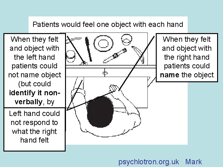 Patients would feel one object with each hand When they felt and object with