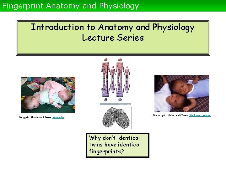 Fingerprint Anatomy and Physiology Introduction to Anatomy and Physiology Lecture Series Monoztgotic (Identical) Twins.