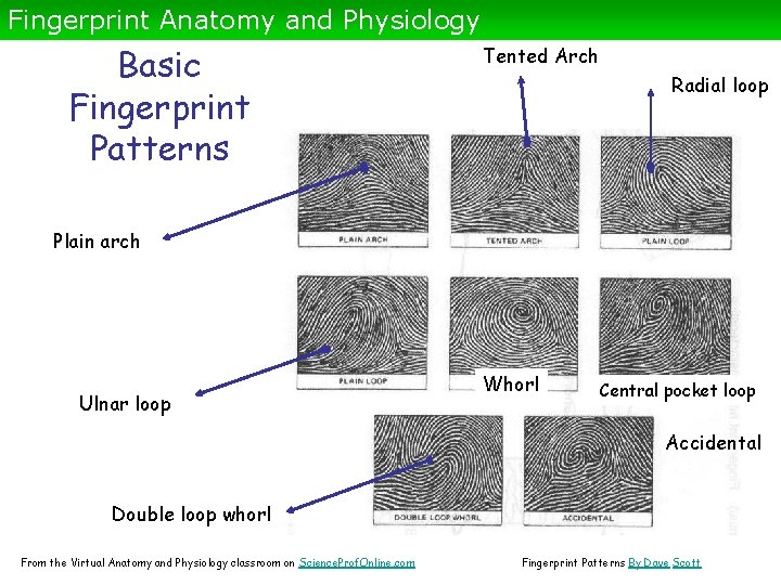 Fingerprint Anatomy and Physiology Basic Fingerprint Patterns Tented Arch Radial loop Plain arch Ulnar