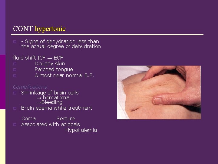 CONT hypertonic p - Signs of dehydration less than the actual degree of dehydration
