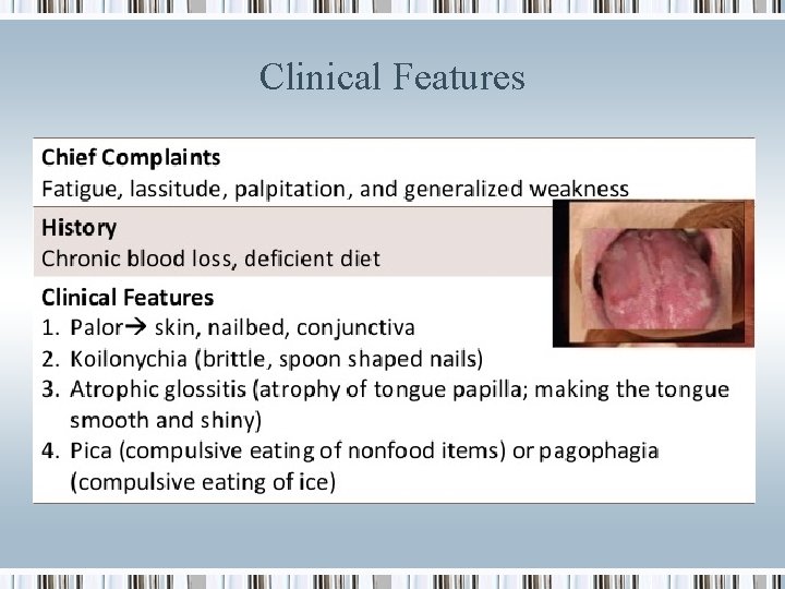 Clinical Features 