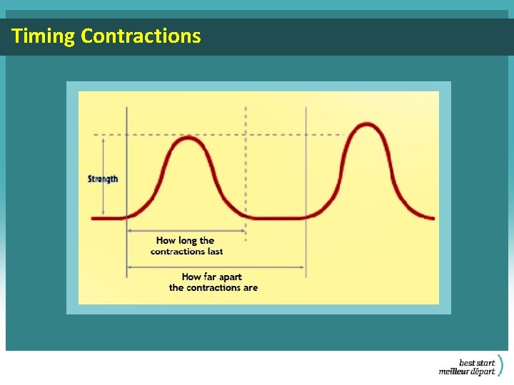 Timing Contractions 