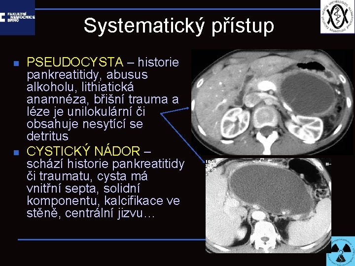 Systematický přístup n n PSEUDOCYSTA – historie pankreatitidy, abusus alkoholu, lithiatická anamnéza, břišní trauma