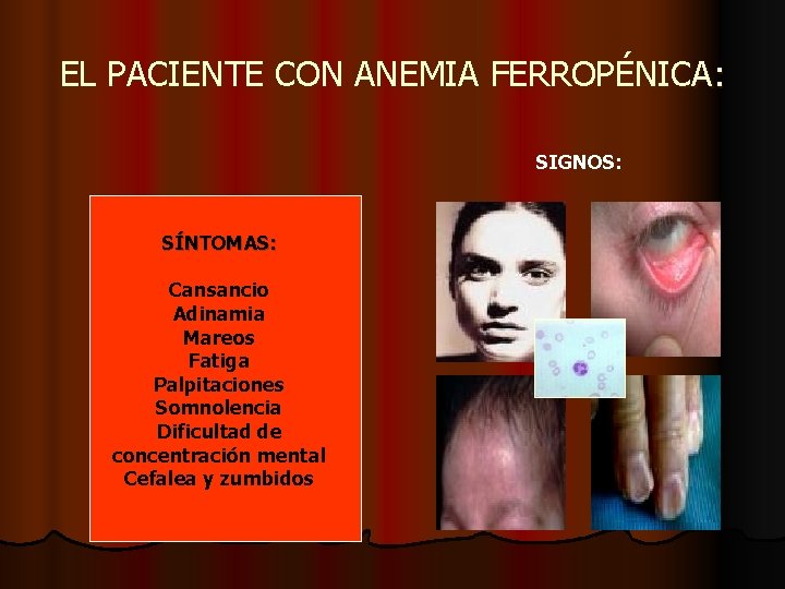 EL PACIENTE CON ANEMIA FERROPÉNICA: SIGNOS: SÍNTOMAS: Cansancio Adinamia Mareos Fatiga Palpitaciones Somnolencia Dificultad