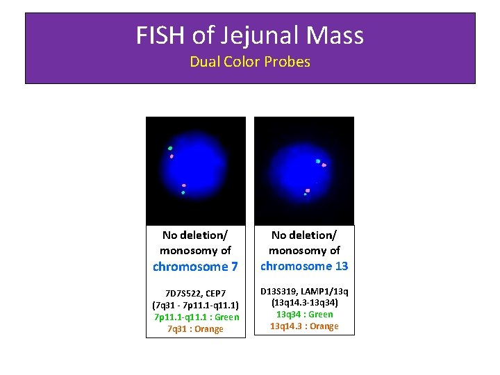 FISH of Jejunal Mass Dual Color Probes No deletion/ monosomy of chromosome 7 chromosome