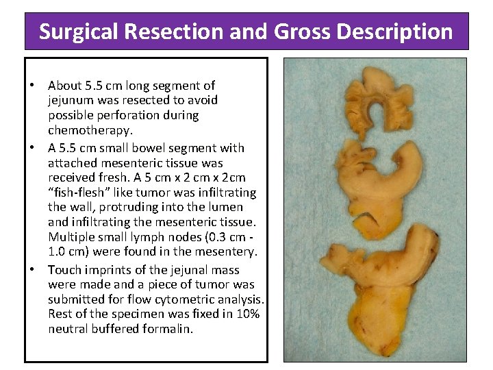 Surgical Resection and Gross Description • About 5. 5 cm long segment of jejunum