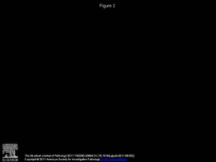 Figure 2 The American Journal of Pathology 2011 1792382 -2396 DOI: (10. 1016/j. ajpath.