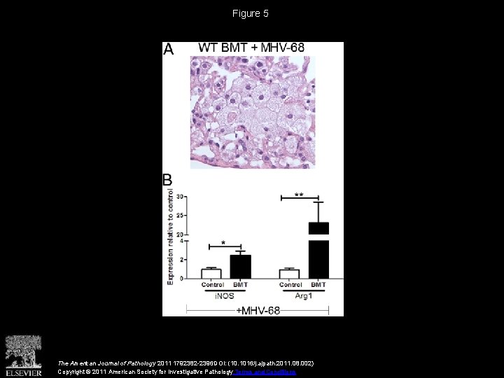 Figure 5 The American Journal of Pathology 2011 1792382 -2396 DOI: (10. 1016/j. ajpath.